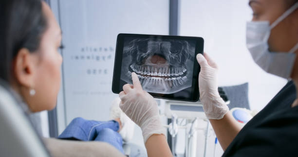 Licensed Root Canal Treatment service in Federal Way, WA - Smile Center Dentistry